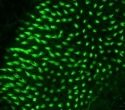 Unique combination of transcription factors trigger cell regeneration in zebrafish