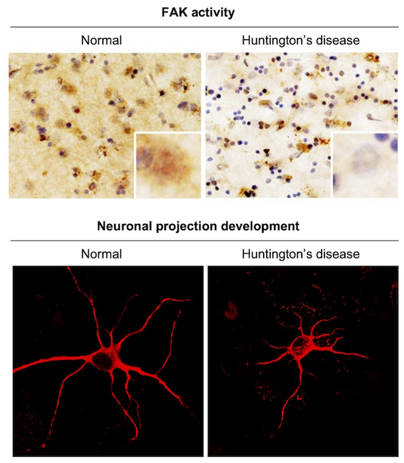Novel molecular mechanism of focal adhesion kinase inhibition in HD
