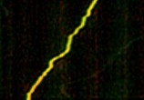 New role for huntingtin protein—neuronal regeneration