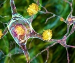 New role for huntingtin protein—neuronal regeneration