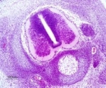 Mechanical Forces Directing the Eye Formation in Healthy Chick Embryos
