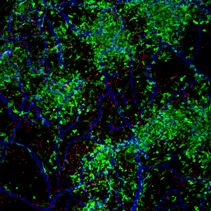 Brain-resident and recruited macrophages exhibit diverging responses