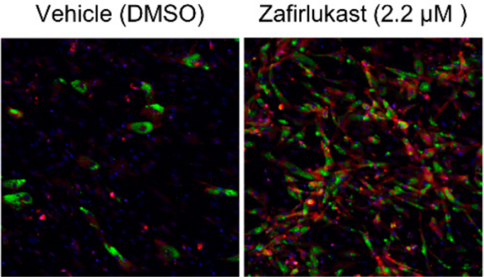 Drug discovery method facilitates promising treatment approaches for metabolic diseases