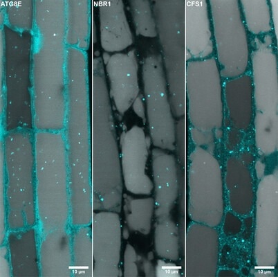 Conserved vacuolar sorting hub regulates autophagic flux in plants
