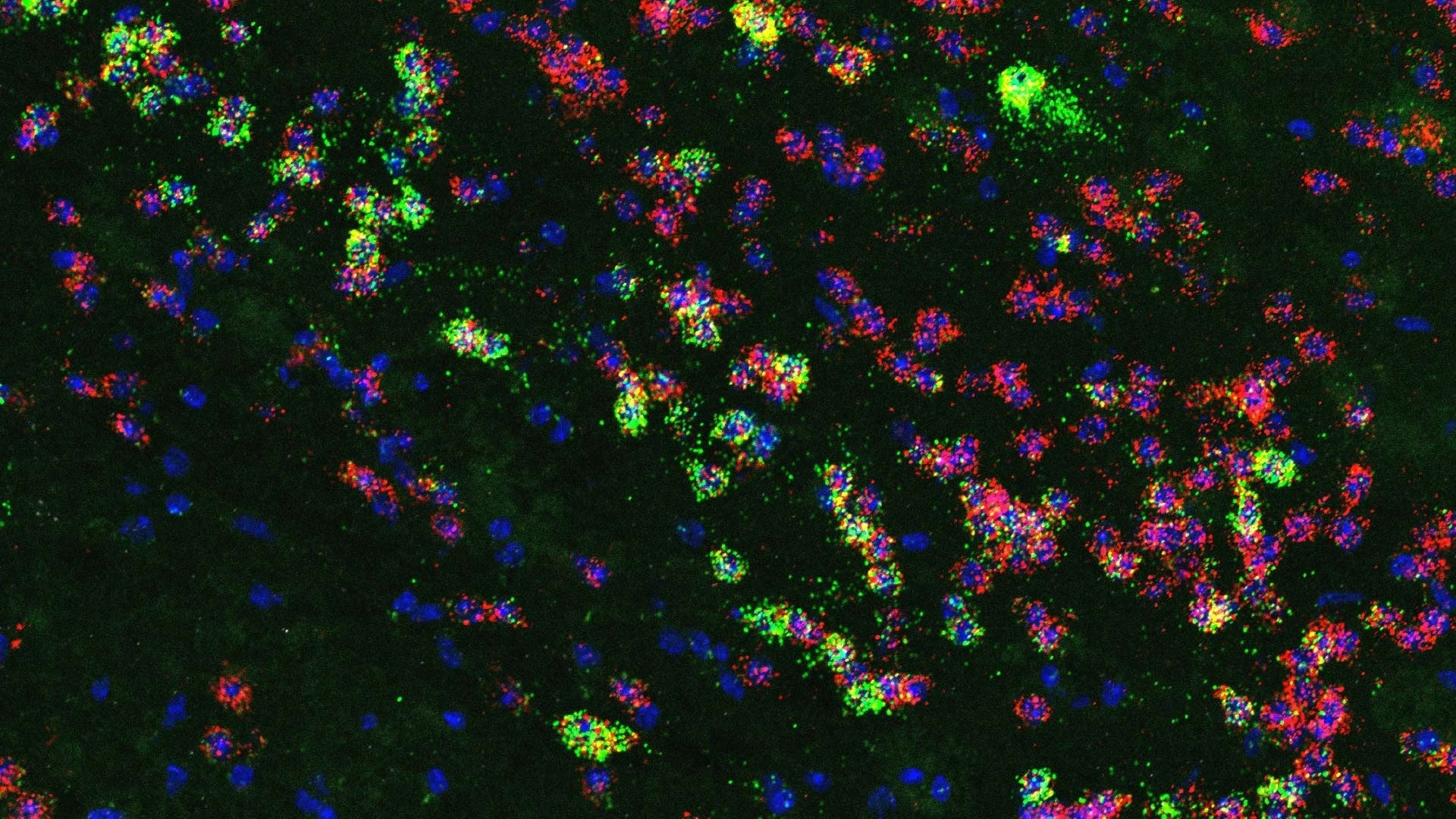 Key to developing more effective obesity treatments