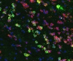 Key to developing more effective obesity treatments