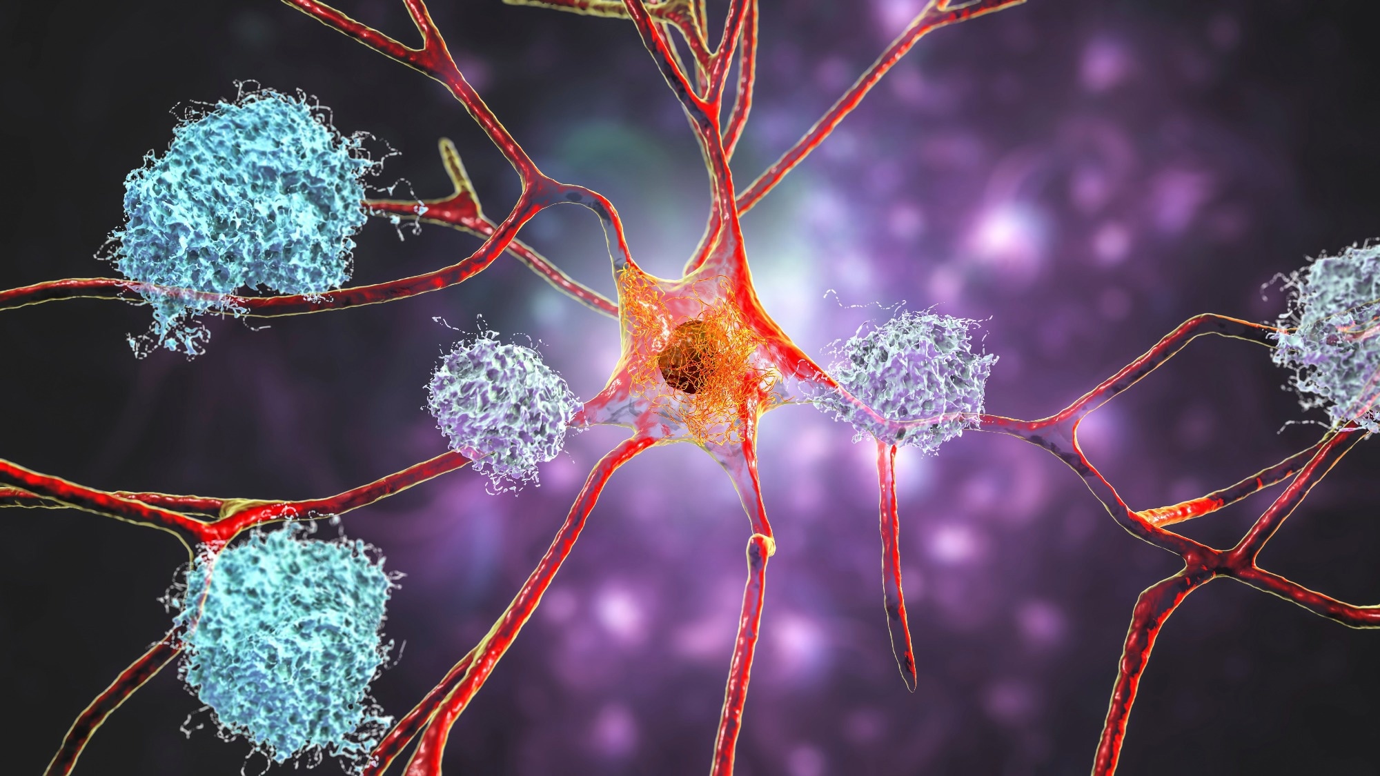 Gene governing cell division could shield against Alzheimer’s