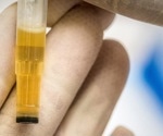 Inexpensive recombinant protein production induced by urea