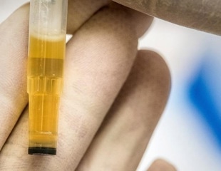 Inexpensive recombinant protein production induced by urea