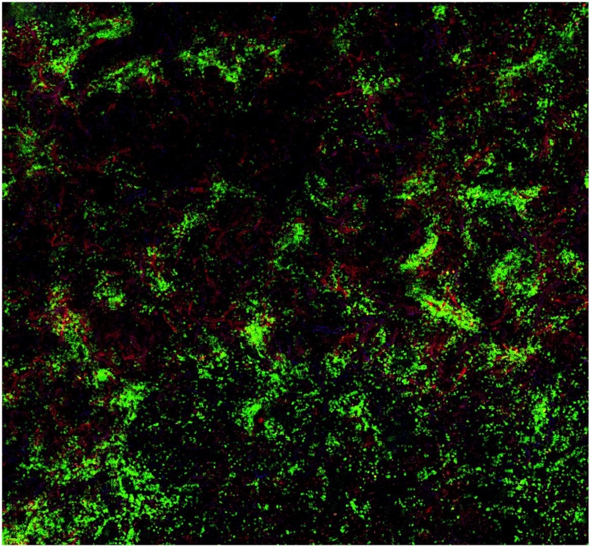Immunological mechanisms behind the development of alloantibodies