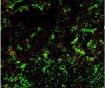 Immunological mechanisms behind the development of alloantibodies
