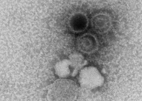 Resistance against Epstein-Barr virus from experimental monoclonal antibodies