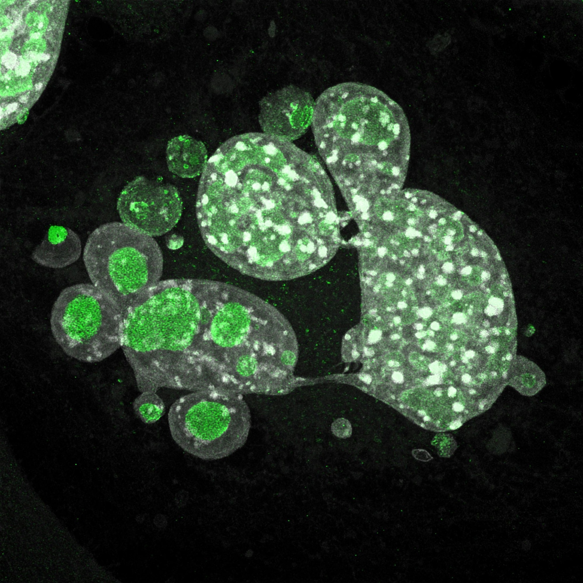 Role of p53-mediated metabolism in preventing genomic instability