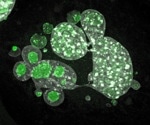 Role of p53-mediated metabolism in preventing genomic instability
