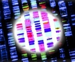 Multidisciplinary analysis of WGS improves diagnostic rates