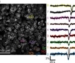 Rapid fluctuations in electrical activity within breast cancer cells identified