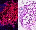 NIH funds research on mRNA vaccines to stop cancer development
