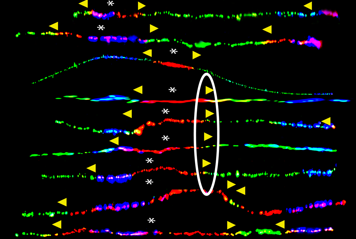 Revealing cancer development in people carrying inherited BRCA1 mutations