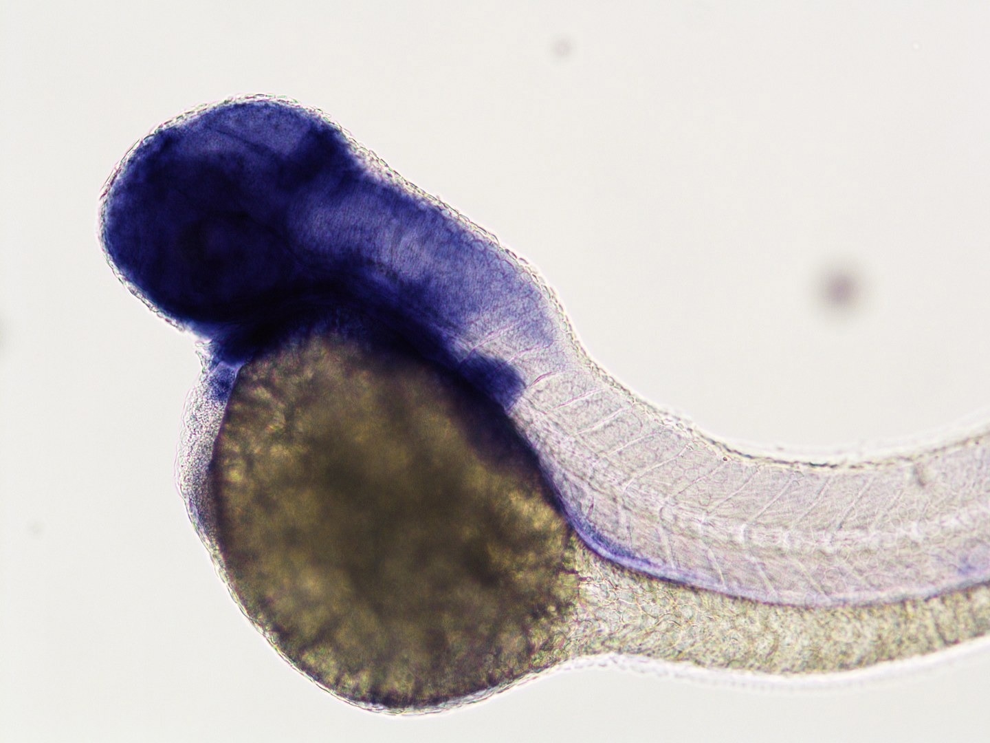 A gene’s function in embryonic development