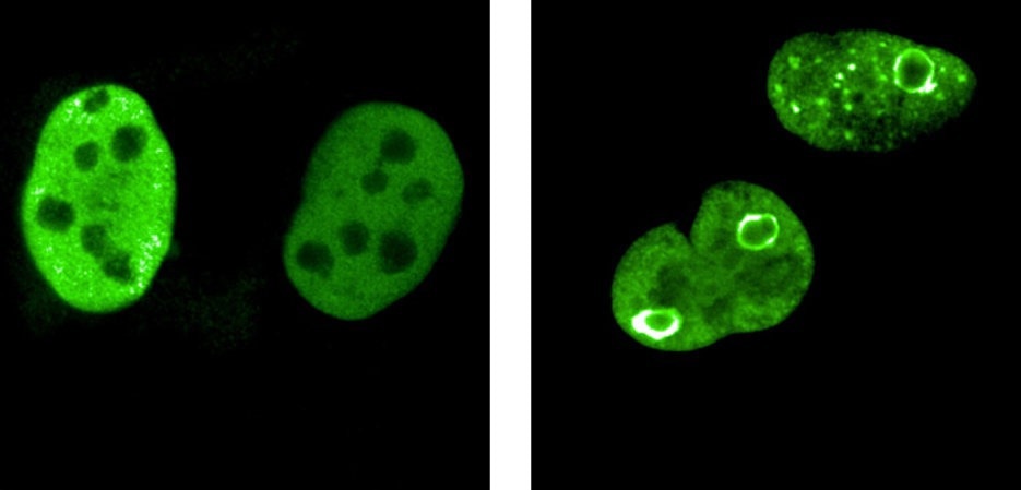 Breakthrough on the way to new therapeutic strategies