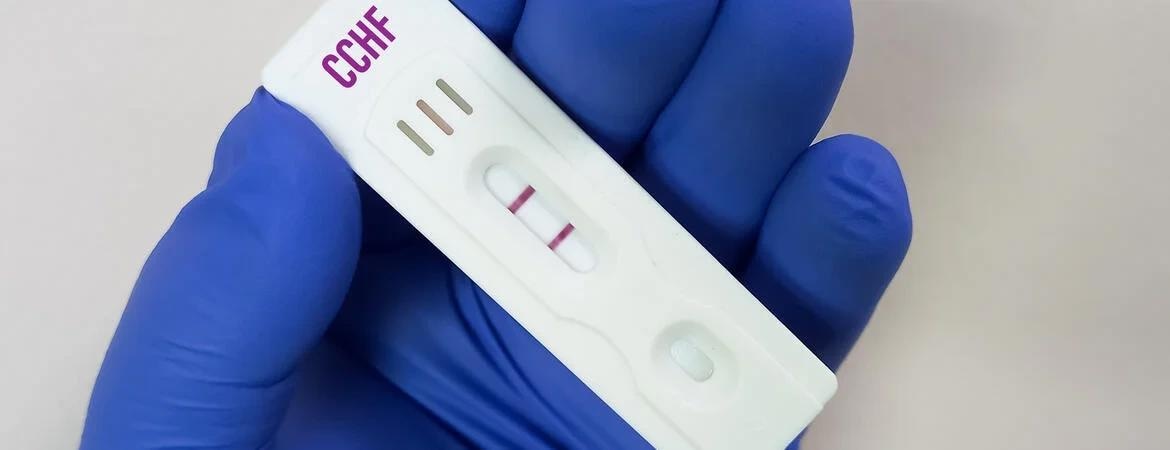 Insight into the treatment for Crimean Congo Hemorrhagic Fever Virus