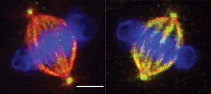 Revealing the mechanism that ensures genome stability in normal cells