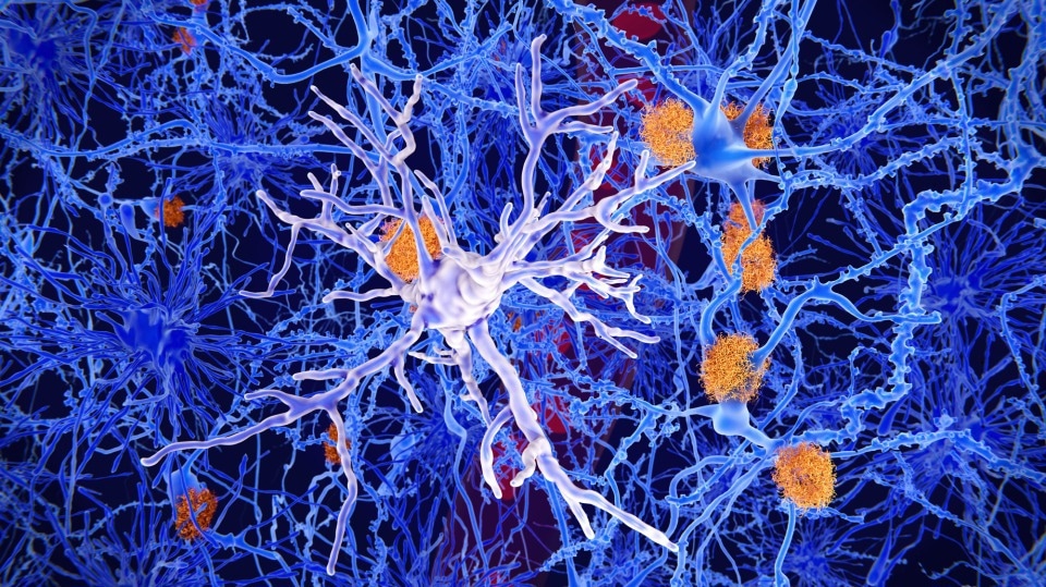 Microglial cells trigger inflammatory protective mechanisms in the immune system