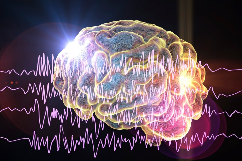 Epilepsy