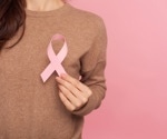 Predictive classifier identifies patients who can skip radiation therapy
