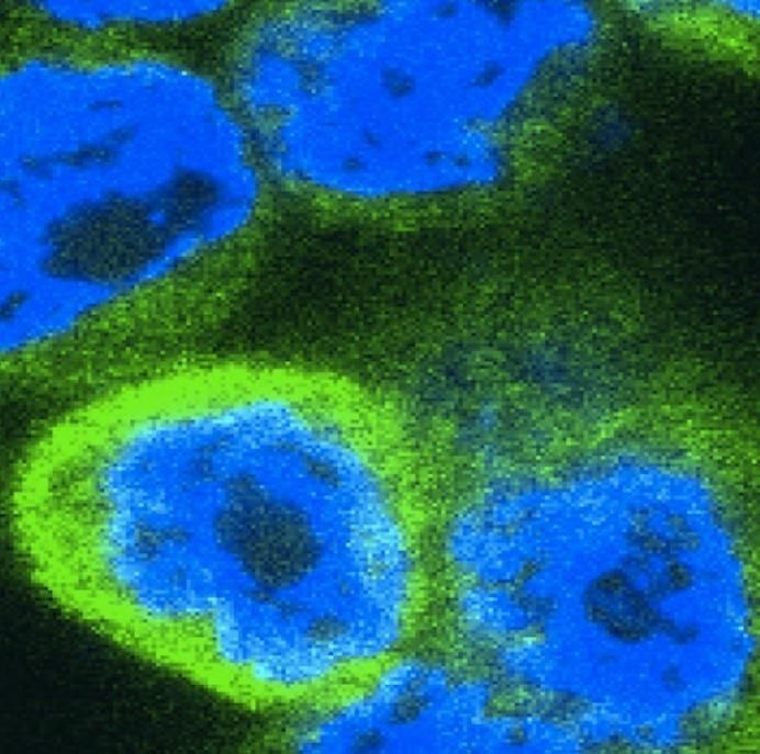Key immune alarm protein that regulates inflammation identified