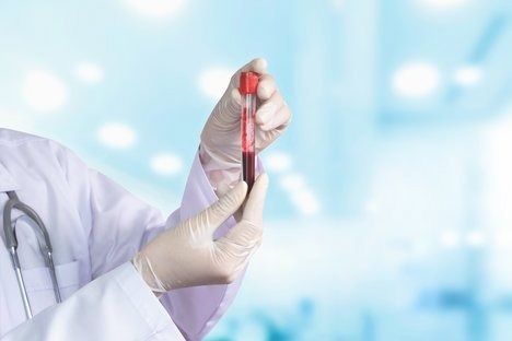 Novel blood biomarker predicts a favorable response to CART cell therapy