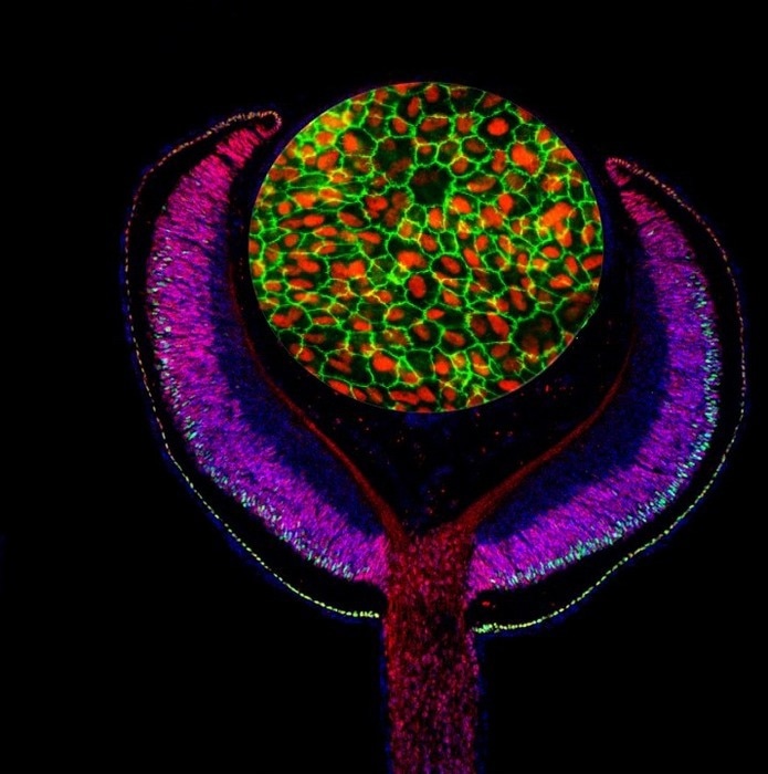 Blending multiple maps uncover new genetic causes of blindness