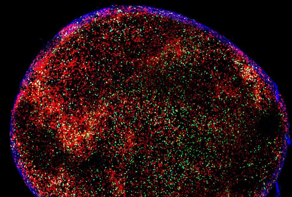 New revelations on the immune system’s defenses against infections