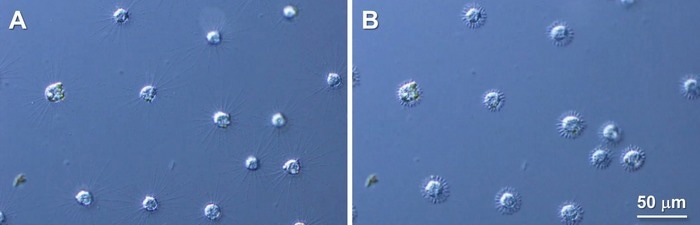Molecular mechanism behind microtubule dynamics in R. contractilis