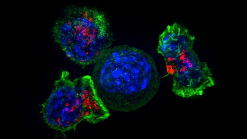 Tumor progression after immunotherapy: Molecular pathways revealed