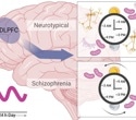 The 12-hour cyclic gene activity abnormalities in schizophrenic brains