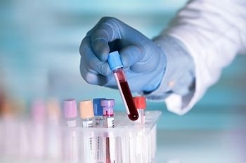 Easy-to-use method quantifies exosomal miRNAs