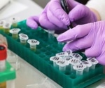 Non-immunosuppressive strategy mitigates immune-mediated intestinal diseases