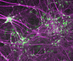 Potential approach for mitigating ALS pathogenesis