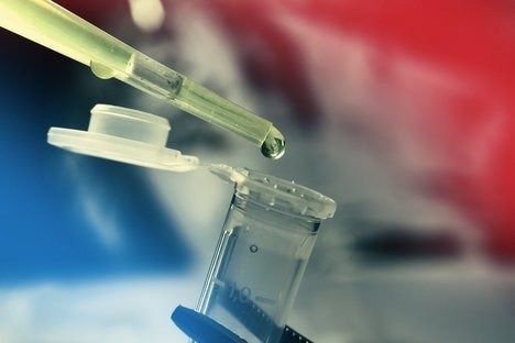 Importance of epigenetic regulation in the recovery of T cells