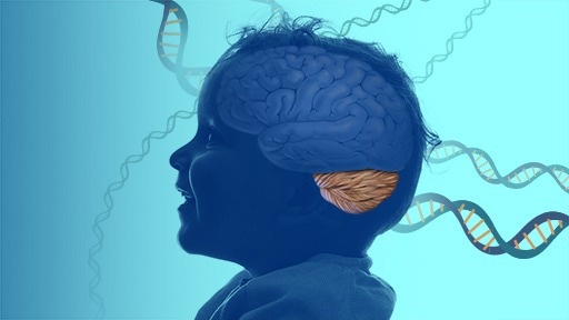 Rare disease involving speech and motor coordination difficulties identified