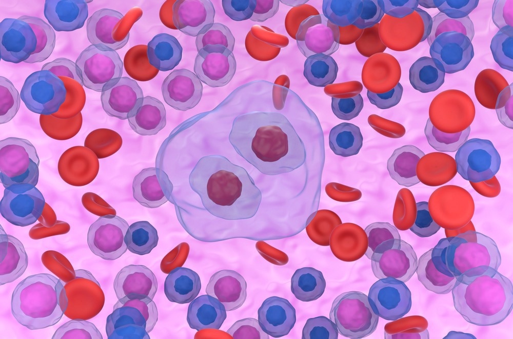 Hodgkin lymphoma