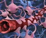Realistic model explores new treatments for brain tumors
