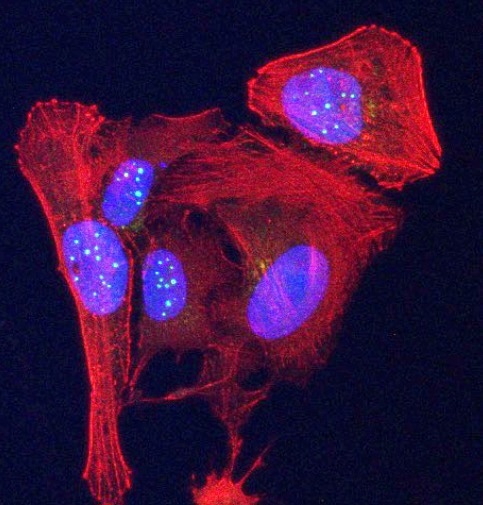 New biomarker helps identify biological age