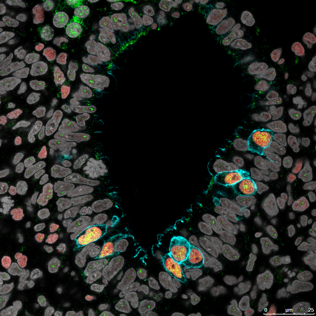 Robust method for induced pluripotent stem cell culture