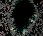 Robust method for induced pluripotent stem cell culture