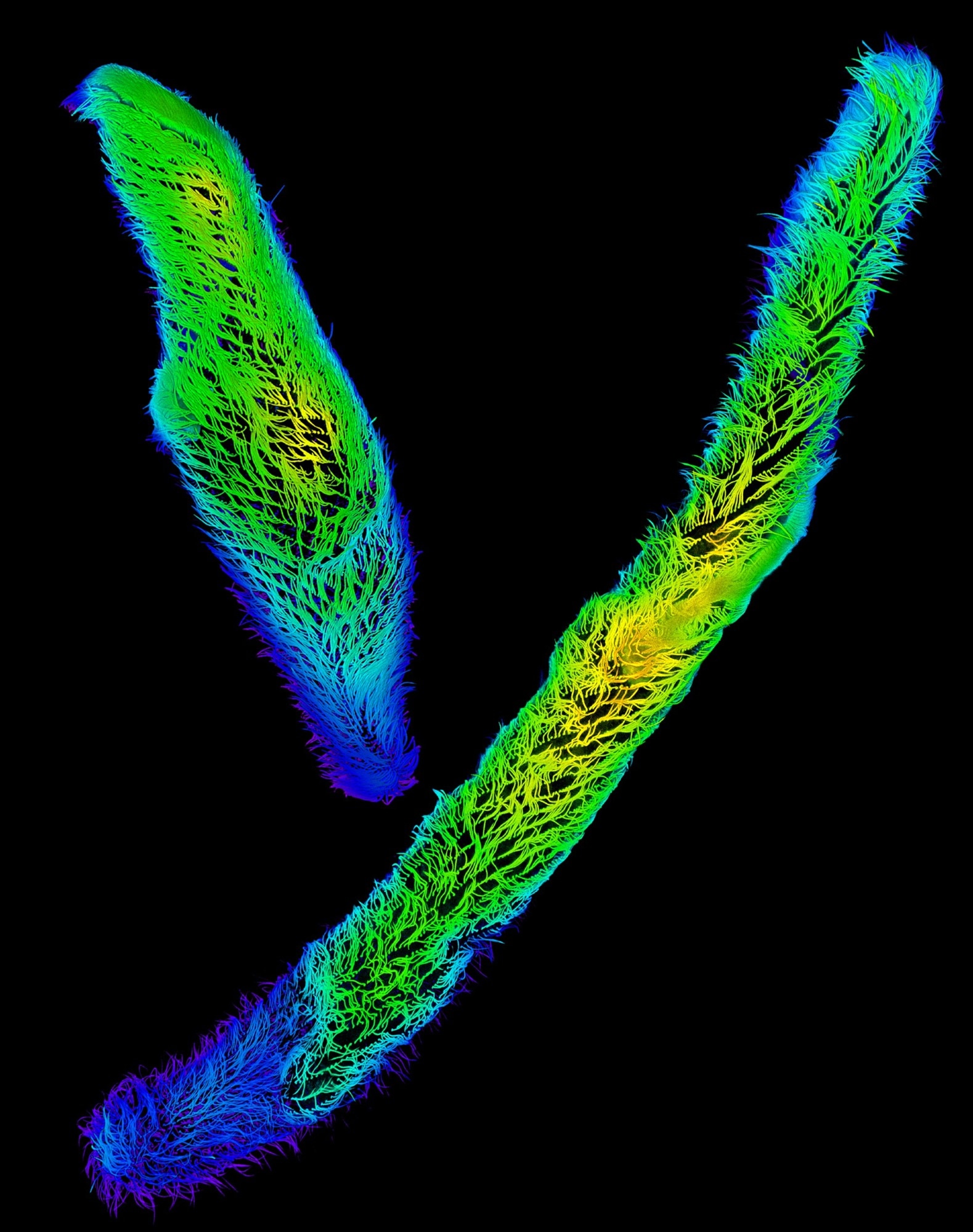 Describing the molecular basis behind the ultrafast contraction of Spirostomum
