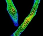 Describing the molecular basis behind the ultrafast contraction of Spirostomum