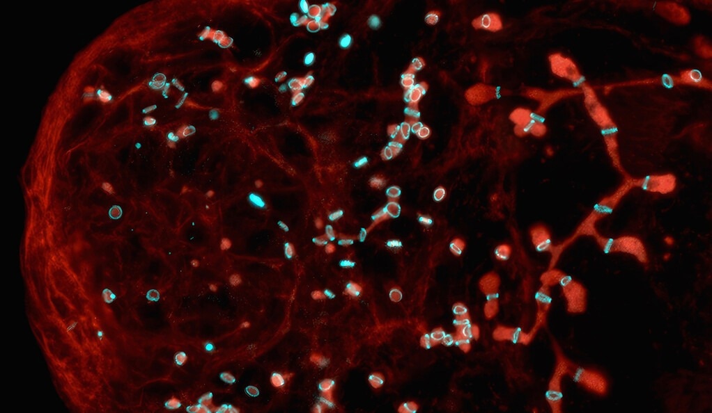 The mechanism behind fruit fly germ cells forming ring canals