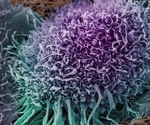 High correlation between the product of a gene in the majority of cancers